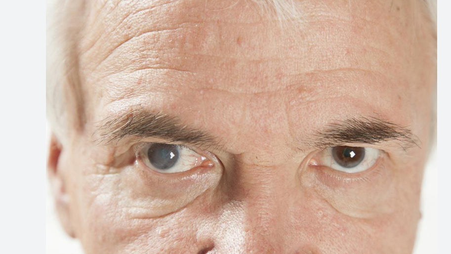Optometrists: Your First Line Of Defense Against Cataracts