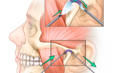 The Role Of General Dentists In The Management Of TMJ Disorders