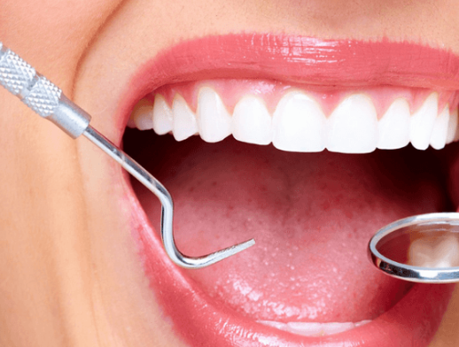 Dental Implants Vs. Fixed Bridges: Choosing The Best Solution